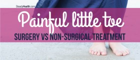 Bunionette pain relief: Surgery vs. Home Treatment For Management Of Painful Little Toe